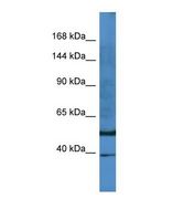 E2F8 Antibody - Western blot of Human PANC1. E2F8 antibody dilution 1.0 ug/ml.  This image was taken for the unconjugated form of this product. Other forms have not been tested.
