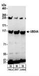 E4 / UBE4A Antibody - Detection of Human UBE4A by Western Blot. Samples: Whole cell lysate (50 ug) from HeLa, 293T, and Jurkat cells. Antibodies: Affinity purified rabbit anti-UBE4A antibody used for WB at 0.4 ug/ml. Detection: Chemiluminescence with an exposure time of 3 minutes.