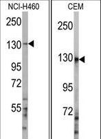 E4 / UBE4A Antibody - Western blot of anti-UBE4A Antibody in NCI-H460 and CEM cell line lysates (35 ug/lane). UBE4A (arrow) was detected using the purified antibody.