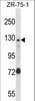 E4 / UBE4A Antibody - UBE4A Antibody western blot of ZR-75-1 cell line lysates (35 ug/lane). The UBE4A antibody detected the UBE4A protein (arrow).