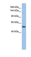 E4 / UBE4A Antibody - UBE4A antibody Western blot of 721_B cell lysate. This image was taken for the unconjugated form of this product. Other forms have not been tested.