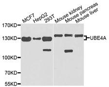 E4 / UBE4A Antibody - Western blot analysis of extracts of various cells.