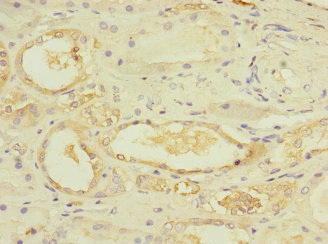 E4 / UBE4A Antibody - Immunohistochemistry of paraffin-embedded human kidney tissue at dilution 1:100