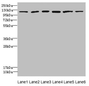 E4 / UBE4A Antibody - Western blot All Lanes: UBE4A antibody at 2.24ug/ml Lane 1: K562 whole cell lysate Lane 2: MCF7 whole cell lysate Lane 3: Jurkat whole cell lysate Lane 4: Caco-2 whole cell lysate Lane 5: HepG-2 whole cell lysate Lane 6: 293T whole cell lysate Secondary Goat polyclonal to rabbit IgG at 1/10000 dilution Predicted band size: 123,124 kDa Observed band size: 123 kDa