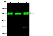 E4 / UBE4A Antibody - Anti-UBE4A rabbit polyclonal antibody at 1:500 dilution. Lane A: 293T Whole Cell Lysate. Lane B: HepG2 Whole Cell Lysate. Lane C: Jurkat Whole Cell Lysate. Lysates/proteins at 30 ug per lane. Secondary: Goat Anti-Rabbit IgG H&L (Dylight 800) at 1/10000 dilution. Developed using the Odyssey technique. Performed under reducing conditions. Predicted band size: 123 kDa. Observed band size: 125 kDa. (We are unsure as to the identity of these extra bands.)