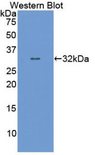E6AP / UBE3A Antibody - Western blot of recombinant E6AP / UBE3A.
