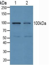 E6AP / UBE3A Antibody - Western Blot; Sample: Lane1: Human Jurkat Cells; Lane2: Human K562 Cells.