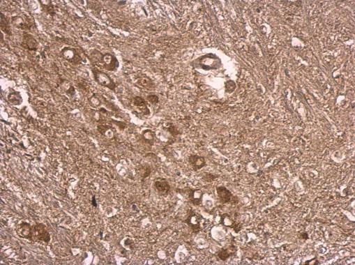 E6AP / UBE3A Antibody - Anti-UBE3A antibody used in IHC (Formalin-fixed paraffin-embedded sections).