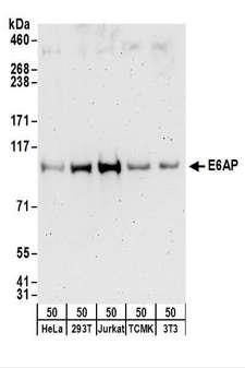 E6AP / UBE3A Antibody - Detection of Human and Mouse E6AP by Western Blot. Samples: Whole cell lysate (50 ug) from HeLa, 293T, Jurkat, mouse TCMK-1, and mouse NIH3T3 cells. Antibodies: Affinity purified rabbit anti-E6AP antibody used for WB at 0.4 ug/ml. Detection: Chemiluminescence with an exposure time of 3 minutes.