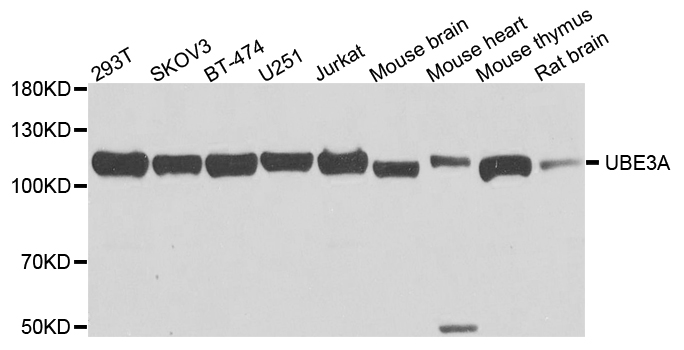 E6AP / UBE3A Antibody - Western blot analysis of extracts of various cell lines, using UBE3A antibody at 1:1000 dilution. The secondary antibody used was an HRP Goat Anti-Rabbit IgG (H+L) at 1:10000 dilution. Lysates were loaded 25ug per lane and 3% nonfat dry milk in TBST was used for blocking. An ECL Kit was used for detection and the exposure time was 5s.