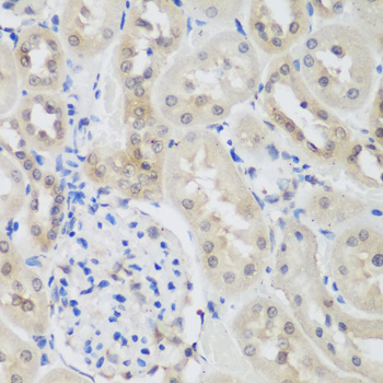 E6AP / UBE3A Antibody - Immunohistochemistry of paraffin-embedded rat kidney using UBE3A antibodyat dilution of 1:200 (40x lens).