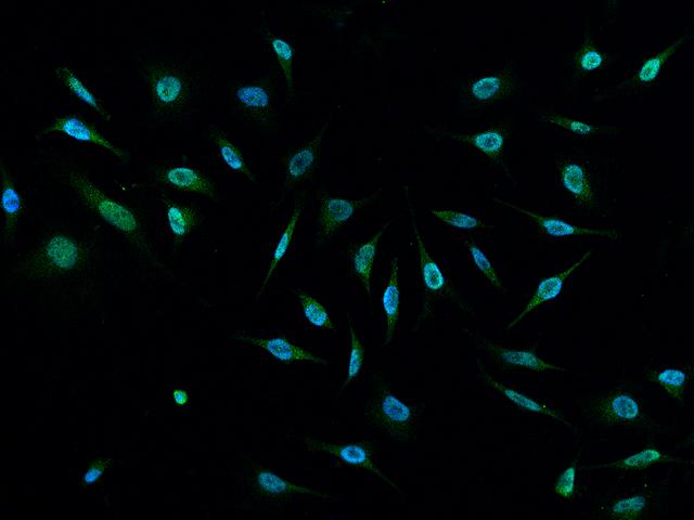 E6AP / UBE3A Antibody - Immunofluorescence staining of UBE3A in Hela cells. Cells were fixed with 4% PFA, permeabilzed with 0.1% Triton X-100 in PBS, blocked with 10% serum, and incubated with rabbit anti-Human UBE3A polyclonal antibody (dilution ratio 1:1000) at 4°C overnight. Then cells were stained with the Alexa Fluor 488-conjugated Goat Anti-rabbit IgG secondary antibody (green) and counterstained with DAPI (blue). Positive staining was localized to Nucleus.