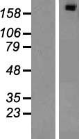 E6TP1 / SIPA1L1 Protein - Western validation with an anti-DDK antibody * L: Control HEK293 lysate R: Over-expression lysate