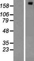 E6TP1 / SIPA1L1 Protein - Western validation with an anti-DDK antibody * L: Control HEK293 lysate R: Over-expression lysate