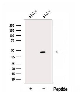 EAF1 / ELL Associated Factor 1 Antibody - Western blot analysis of extracts of HeLa cells using EAF1 antibody. The lane on the left was treated with blocking peptide.