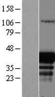 EAF1 / ELL Associated Factor 1 Protein - Western validation with an anti-DDK antibody * L: Control HEK293 lysate R: Over-expression lysate