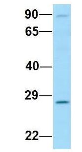 EAF2 / U19 Antibody - EAF2 / U19 antibody Western Blot of Human Placenta. Antibody Dilution: 1.0 ug/ml. Antibody dilution: 1 ug/ml.  This image was taken for the unconjugated form of this product. Other forms have not been tested.
