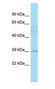 EAF2 / U19 Antibody - EAF2 / U19 antibody Western Blot of Fetal Lung.  This image was taken for the unconjugated form of this product. Other forms have not been tested.