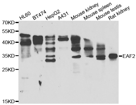 EAF2 / U19 Antibody - Western blot analysis of extracts of various cell lines.
