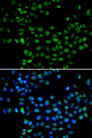 EAF2 / U19 Antibody - Immunofluorescence analysis of A549 cells.