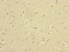 EAF2 / U19 Antibody - Immunohistochemistry of paraffin-embedded human brain tissue at dilution 1:100