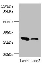 EAF2 / U19 Antibody - Western blot All Lanes: EAF2 antibody at 3.6ug/ml Lane 1: Rat heart tissue Lane 2: Mouse kidney tissue Secondary Goat polyclonal to rabbit IgG at 1/10000 dilution Predicted band size: 29,15 kDa Observed band size: 29 kDa