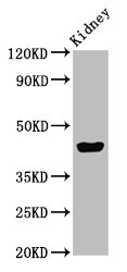 EAF2 / U19 Antibody - Western Blot Positive WB detected in:Mouse kidney tissue All Lanes:EAF2 antibody at 3µg/ml Secondary Goat polyclonal to rabbit IgG at 1/50000 dilution Predicted band size: 29,15 KDa Observed band size: 45 KDa