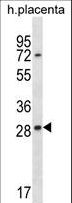 EAN57 Antibody - EAN57 Antibody western blot of human placenta tissue lysates (35 ug/lane). The EAN57 antibody detected the EAN57 protein (arrow).
