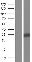 EAN57 Protein - Western validation with an anti-DDK antibody * L: Control HEK293 lysate R: Over-expression lysate