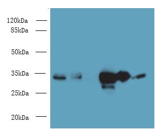 EAPP Antibody - Western blot. All lanes: EAPP antibody at 4 ug/ml. Lane 1: HeLa whole cell lysate. Lane 2: 293T whole cell lysate. Lane 3: Mouse brain tissue. Lane 4: Mouse liver tissue. Lane 5: Mouse kidney tissue. Secondary Goat polyclonal to Rabbit IgG at 1:10000 dilution. Predicted band size: 33 kDa. Observed band size: 33 kDa.