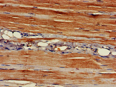 EAPP Antibody - IHC image of EAPP Antibody diluted at 1:400 and staining in paraffin-embedded human skeletal muscle tissue performed on a Leica BondTM system. After dewaxing and hydration, antigen retrieval was mediated by high pressure in a citrate buffer (pH 6.0). Section was blocked with 10% normal goat serum 30min at RT. Then primary antibody (1% BSA) was incubated at 4°C overnight. The primary is detected by a biotinylated secondary antibody and visualized using an HRP conjugated SP system.