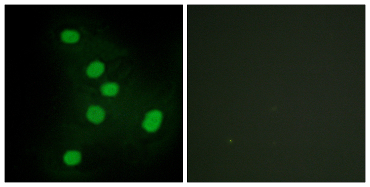 EAR2 / NR2F6 Antibody - Immunofluorescence analysis of HepG2 cells, using NR2F6 Antibody. The picture on the right is blocked with the synthesized peptide.