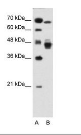 EAR2 / NR2F6 Antibody - A: Marker, HepG2 Cell Lysate.  This image was taken for the unconjugated form of this product. Other forms have not been tested.