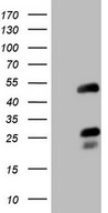 EAR2 / NR2F6 Antibody - HEK293T cells were transfected with the pCMV6-ENTRY control (Left lane) or pCMV6-ENTRY NR2F6 (Right lane) cDNA for 48 hrs and lysed. Equivalent amounts of cell lysates (5 ug per lane) were separated by SDS-PAGE and immunoblotted with anti-NR2F6.