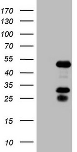 EAR2 / NR2F6 Antibody - HEK293T cells were transfected with the pCMV6-ENTRY control. (Left lane) or pCMV6-ENTRY NR2F6. (Right lane) cDNA for 48 hrs and lysed. Equivalent amounts of cell lysates. (5 ug per lane) were separated by SDS-PAGE and immunoblotted with anti-NR2F6.