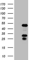 EAR2 / NR2F6 Antibody - HEK293T cells were transfected with the pCMV6-ENTRY control. (Left lane) or pCMV6-ENTRY NR2F6. (Right lane) cDNA for 48 hrs and lysed. Equivalent amounts of cell lysates. (5 ug per lane) were separated by SDS-PAGE and immunoblotted with anti-NR2F6.