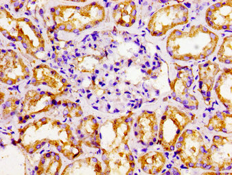 EAR2 / NR2F6 Antibody - Immunohistochemistry image of paraffin-embedded human kidney tissue at a dilution of 1:100