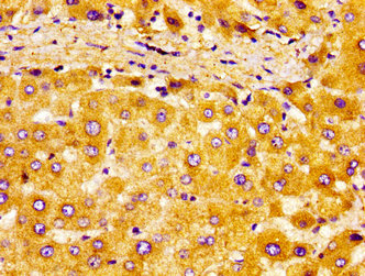 EAR2 / NR2F6 Antibody - Immunohistochemistry image of paraffin-embedded human liver tissue at a dilution of 1:100