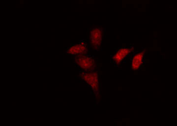 EAR2 / NR2F6 Antibody - Staining HeLa cells by IF/ICC. The samples were fixed with PFA and permeabilized in 0.1% Triton X-100, then blocked in 10% serum for 45 min at 25°C. The primary antibody was diluted at 1:200 and incubated with the sample for 1 hour at 37°C. An Alexa Fluor 594 conjugated goat anti-rabbit IgG (H+L) antibody, diluted at 1/600, was used as secondary antibody.