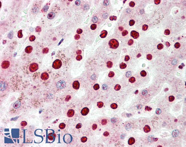 EAR2 / NR2F6 Antibody - Human, Liver: Formalin-Fixed Paraffin-Embedded (FFPE).  This image was taken for the unconjugated form of this product. Other forms have not been tested.