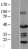 EAR2 / NR2F6 Protein - Western validation with an anti-DDK antibody * L: Control HEK293 lysate R: Over-expression lysate