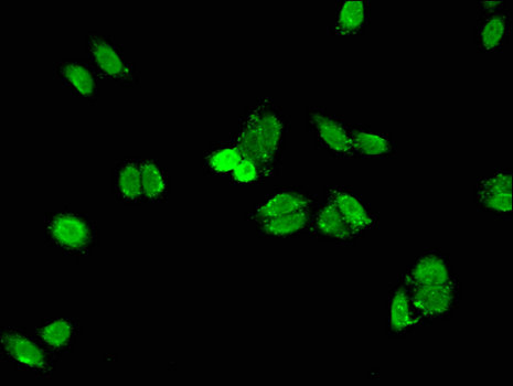EAT2 / SH2D1B Antibody - Immunofluorescent analysis of HepG2 cells using SH2D1B Antibody at a dilution of 1:100 and Alexa Fluor 488-congugated AffiniPure Goat Anti-Rabbit IgG(H+L)