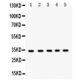 EBAG9 / RCAS1 Antibody - EBAG9 antibody Western blot. All lanes: Anti EBAG9 at 0.5 ug/ml. Lane 1: Rat Testis Tissue Lysate at 50 ug. Lane 2: 22RV1 Whole Cell Lysate at 40 ug. Lane 3: HELA Whole Cell Lysate at 40 ug. Lane 4: MCF-7 Whole Cell Lysate at 40 ug. Lane 5: JURKAT Whole Cell Lysate at 40 ug. Predicted band size: 34 kD. Observed band size: 34 kD.