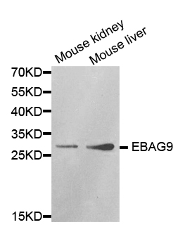 EBAG9 / RCAS1 Antibody - Western blot analysis of extracts of various cell lines.