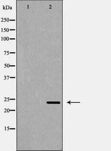 EBAG9 / RCAS1 Antibody - Western blot analysis of HeLa whole cells lysates using EBAG9 antibody. The lane on the left is treated with the antigen-specific peptide.