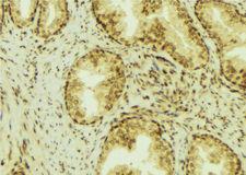 EBAG9 / RCAS1 Antibody - 1:100 staining mouse colon tissue by IHC-P. The sample was formaldehyde fixed and a heat mediated antigen retrieval step in citrate buffer was performed. The sample was then blocked and incubated with the antibody for 1.5 hours at 22°C. An HRP conjugated goat anti-rabbit antibody was used as the secondary.