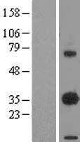 EBAG9 / RCAS1 Protein - Western validation with an anti-DDK antibody * L: Control HEK293 lysate R: Over-expression lysate