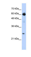 EBF / EBF1 Antibody - EBF1 antibody Western blot of Transfected 293T cell lysate.