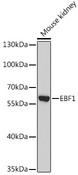 EBF / EBF1 Antibody - Western blot analysis of extracts of Mouse kidney using EBF1 Polyclonal Antibody at dilution of 1:1000.