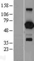 EBF / EBF1 Protein - Western validation with an anti-DDK antibody * L: Control HEK293 lysate R: Over-expression lysate